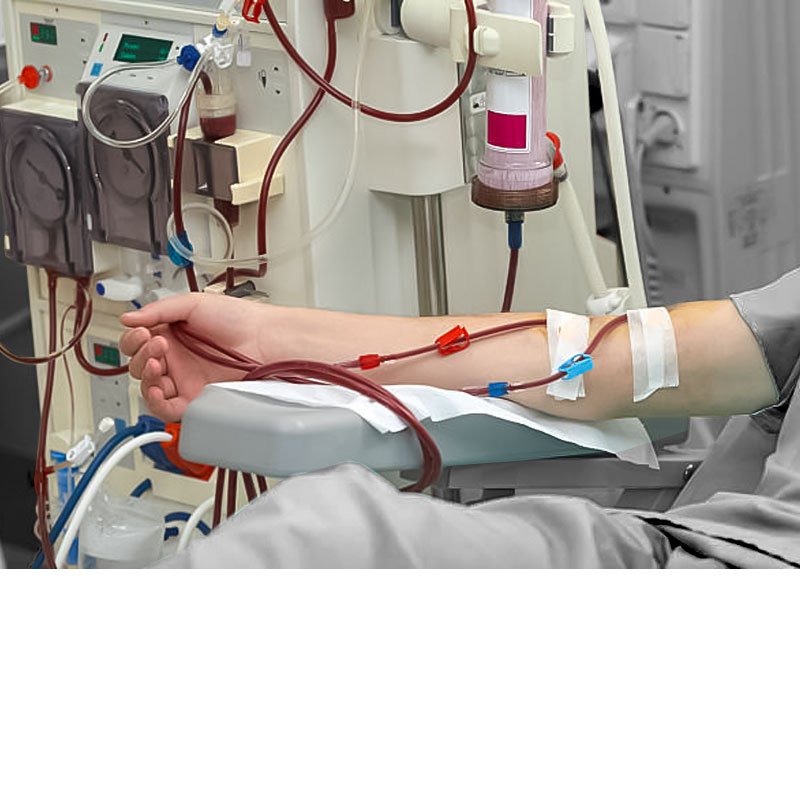 Dialysis Products