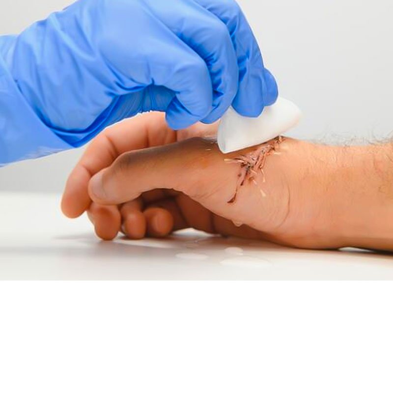 Wound Care