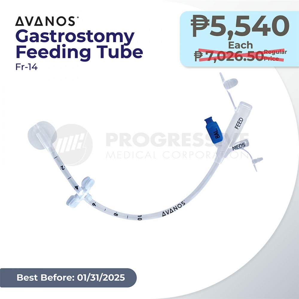 Avanos Gastrostomy Feeding Tube