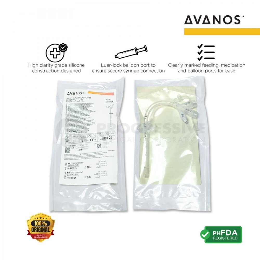 Avanos Gastrostomy Feeding Tube