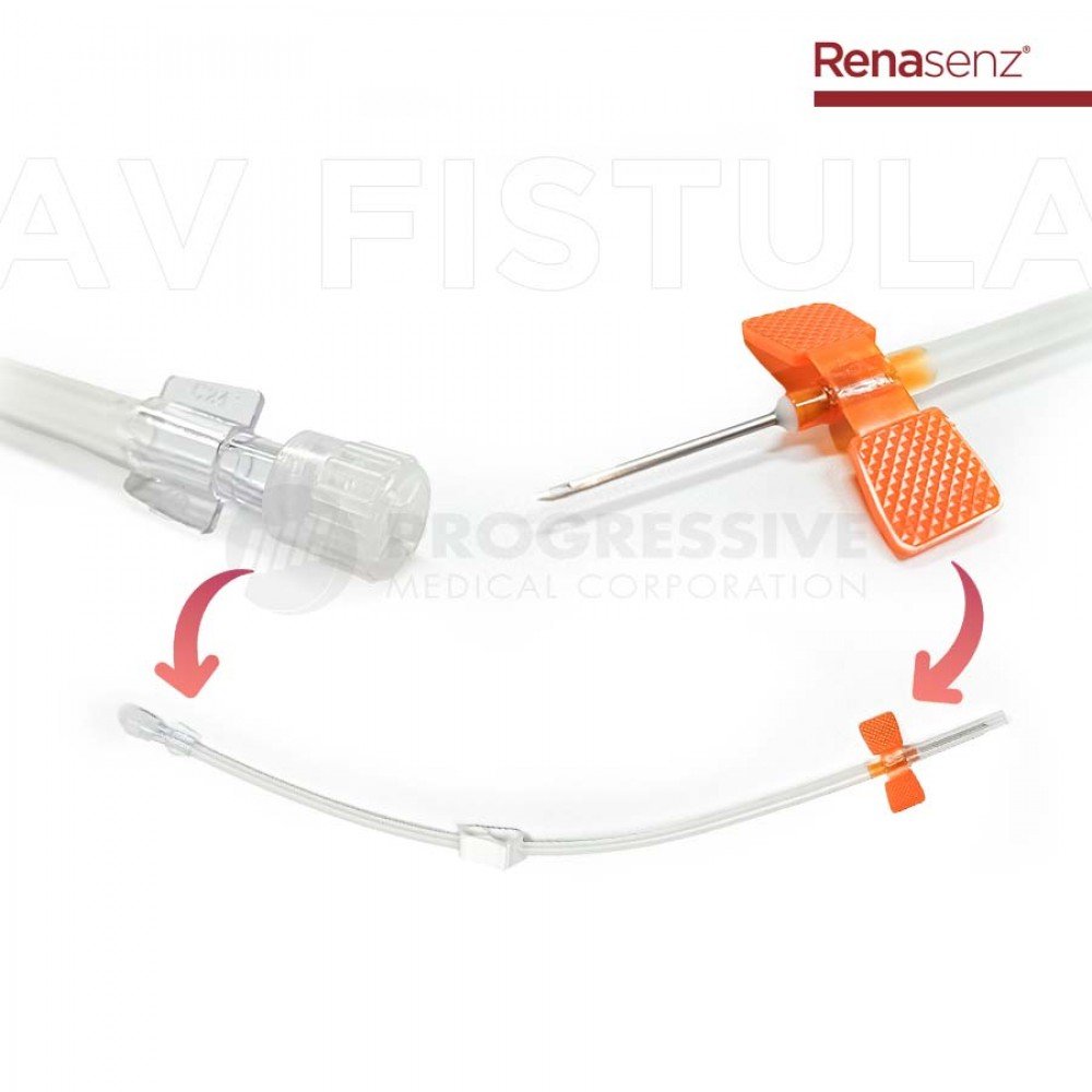 Renasenz AV Fistula with Back-Eye Needle  (Sold per box of 10s)