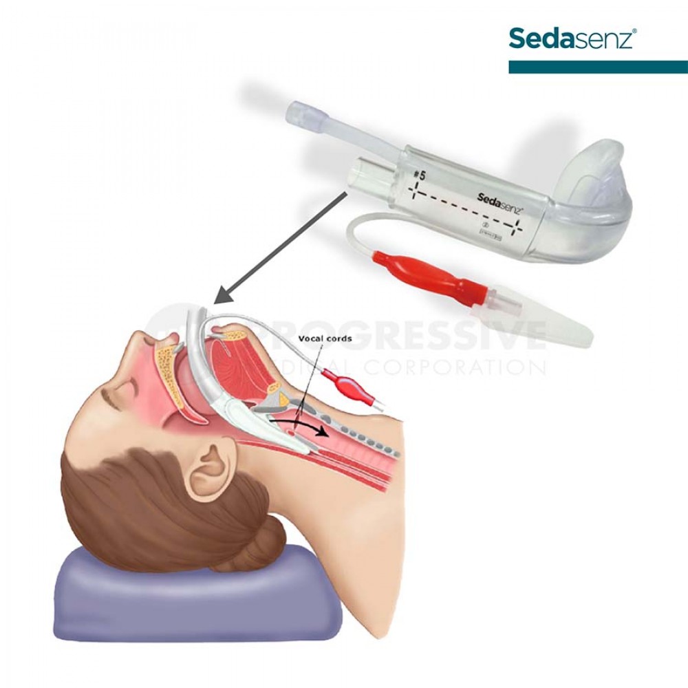 Sedasenz Laryngeal Mask Airway