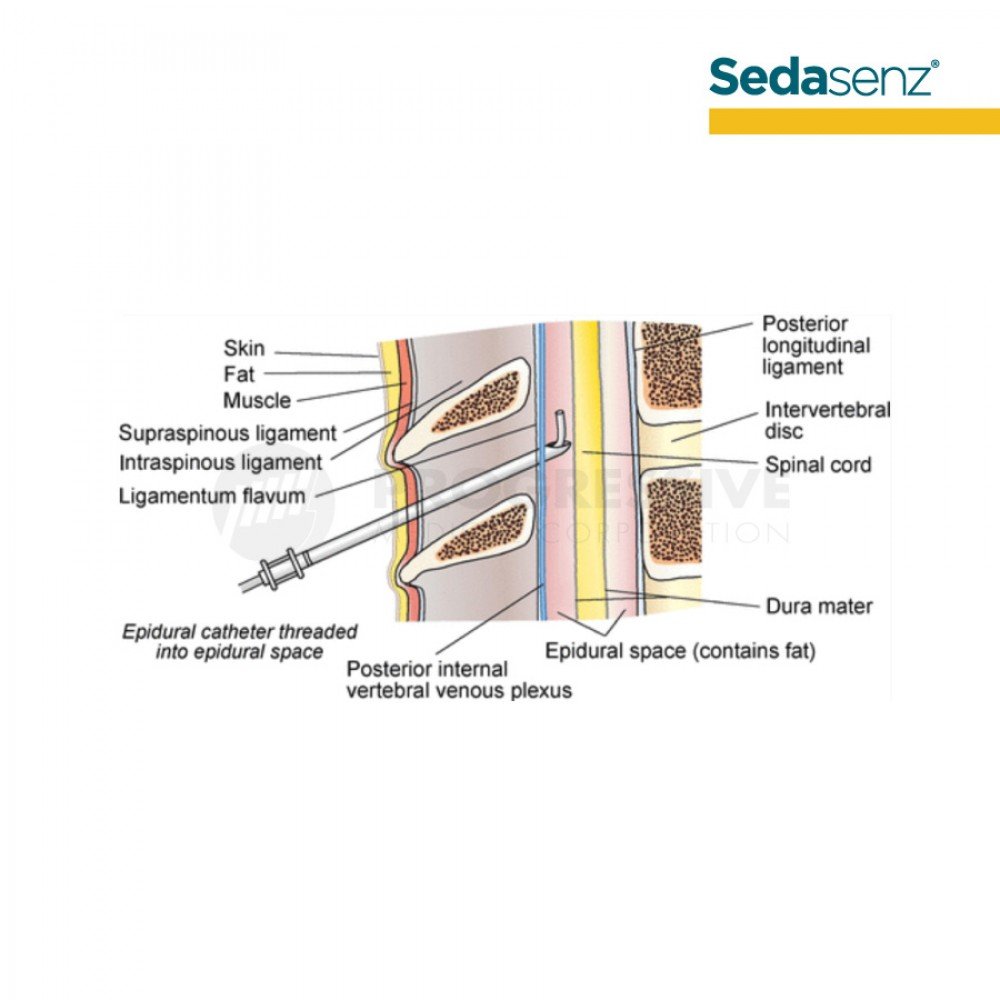 Sedasenz Epidural Kit G18