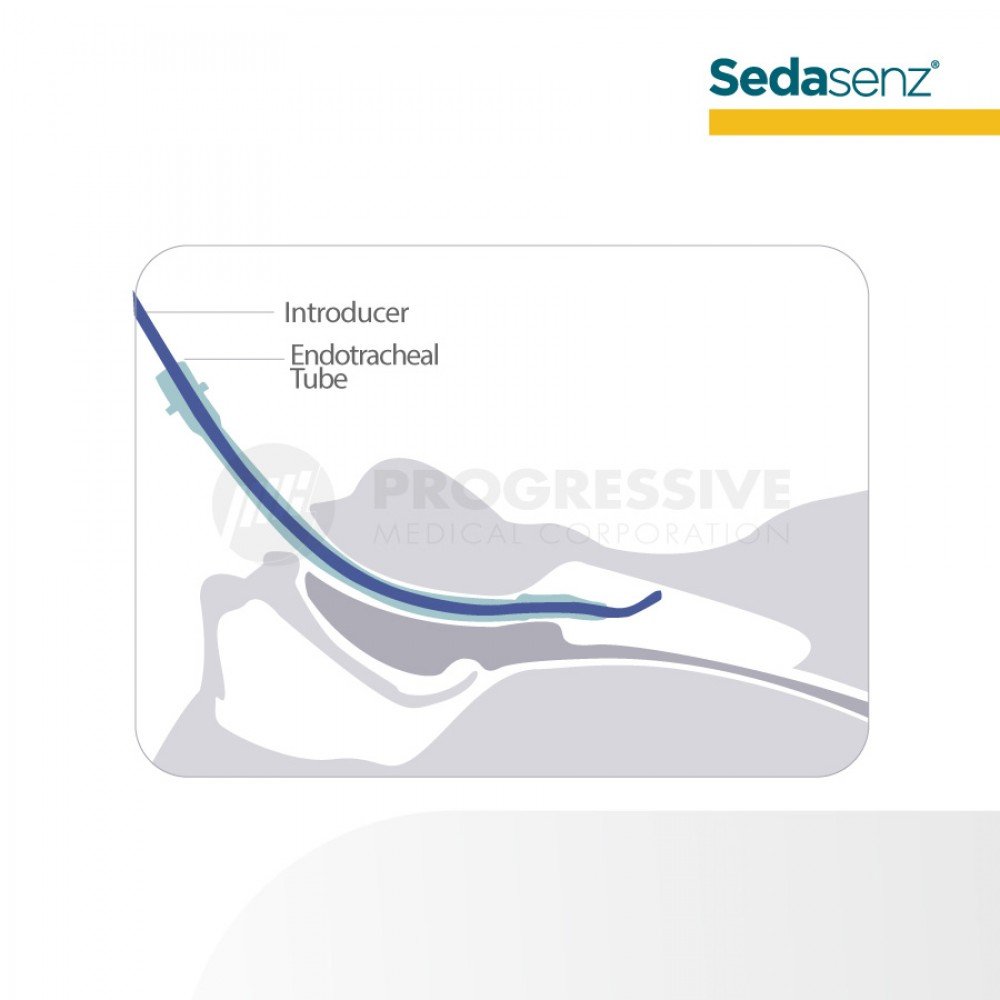 Sedasenz Endotracheal Tube Introducer, Bougie Fr 15 (sold by box of 10s)