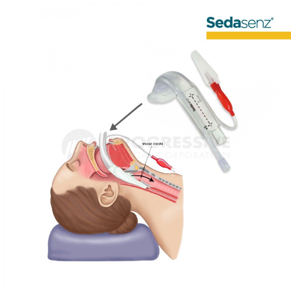 Sedasenz Laryngeal Mask Airway