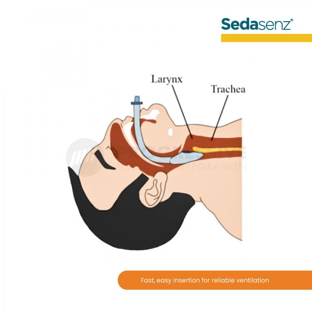 Sedasenz Supraglottic Airway Soft Gel Sedasenz Supraglottic Airway Soft Gel
