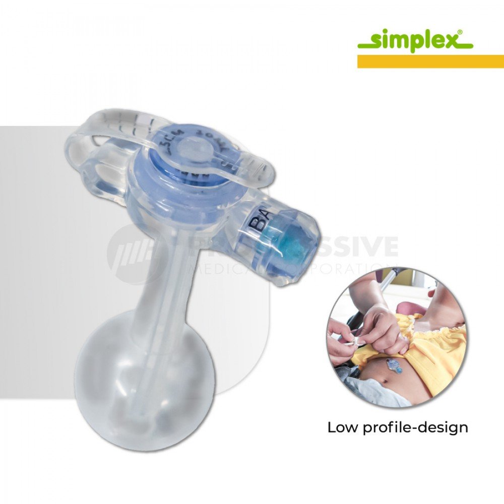 Simplex D-Button Low Profile Gastrostomy Feeding Tube Kit