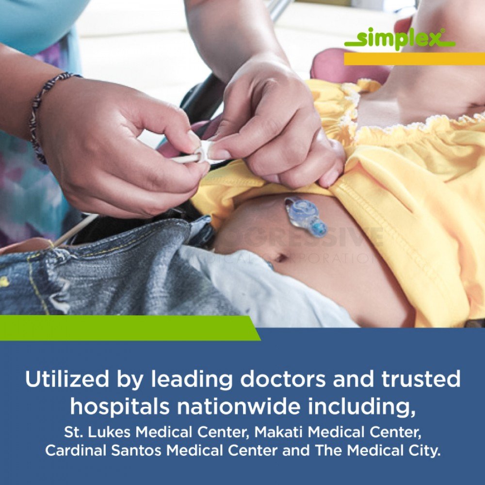 Simplex D-Button Low Profile Gastrostomy Feeding Tube Kit