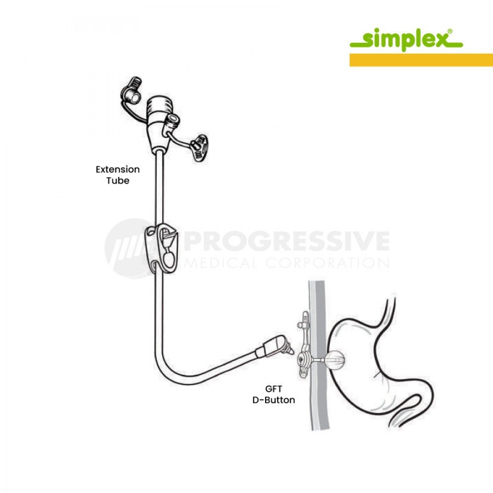 Simplex GFT Feeding Extension Set 