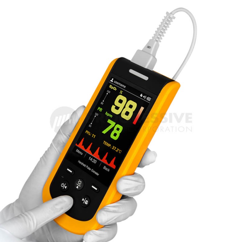 Creative SP20 Handheld Pulse Oximeter