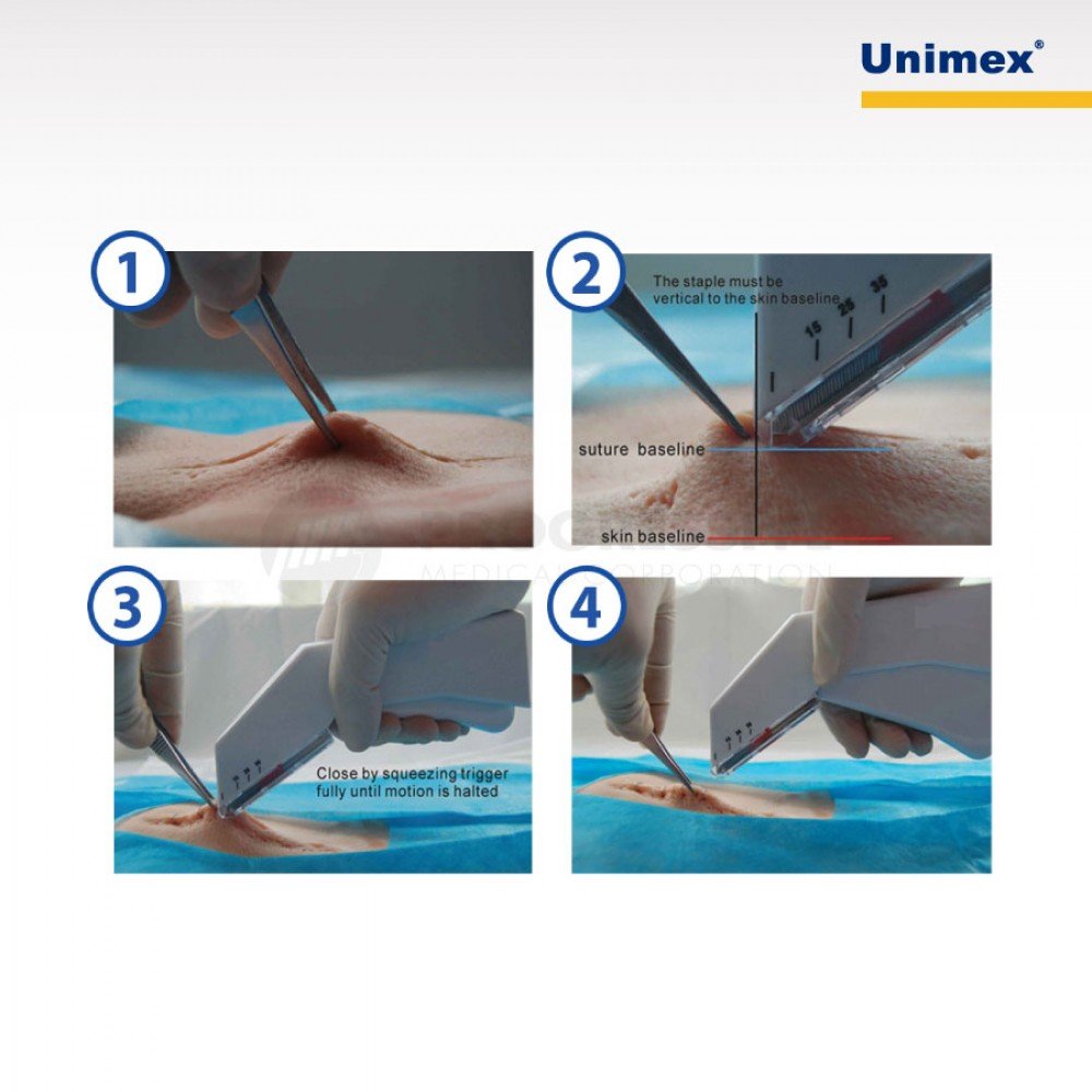 Unimex Skin Stapler