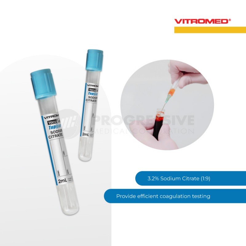Vitromed Blood Collection Tube, Sodium Citrate, 2ml (100s)