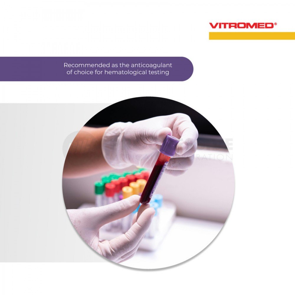 Vitromed Blood Collection Tube, EDTA K2 (100s)