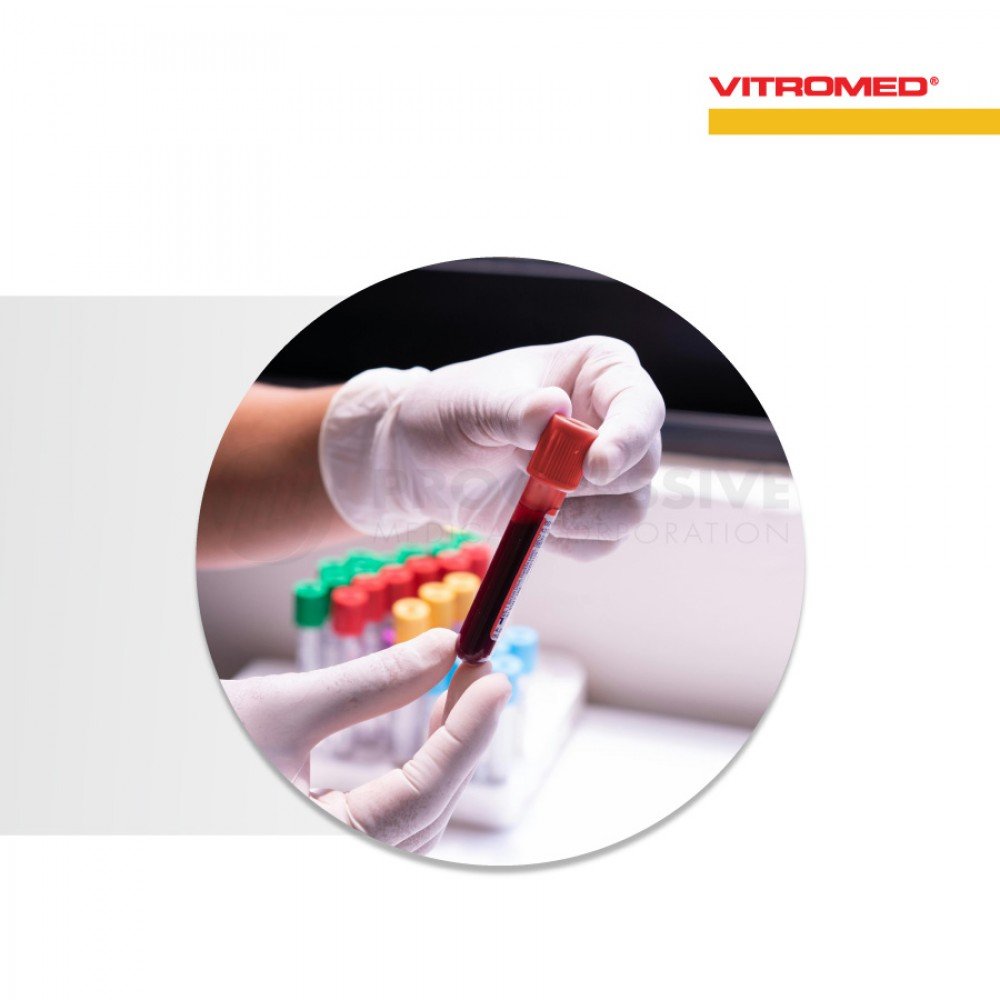 Vitromed Blood Collection Tube, Plain (100s)