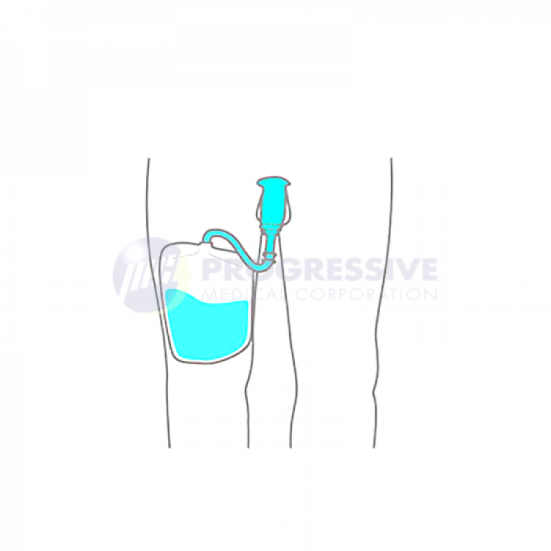 Unimex Male External Condom Catheter