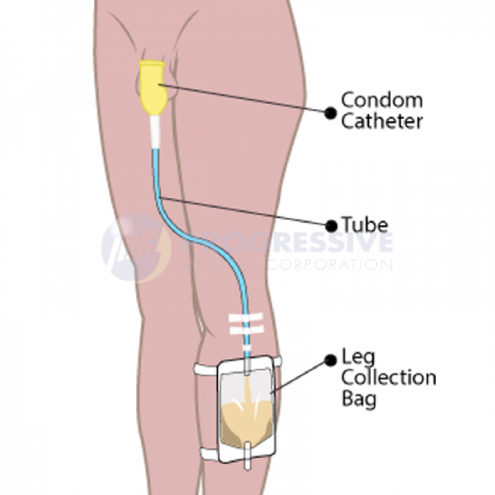 Unimex Male External Condom Catheter